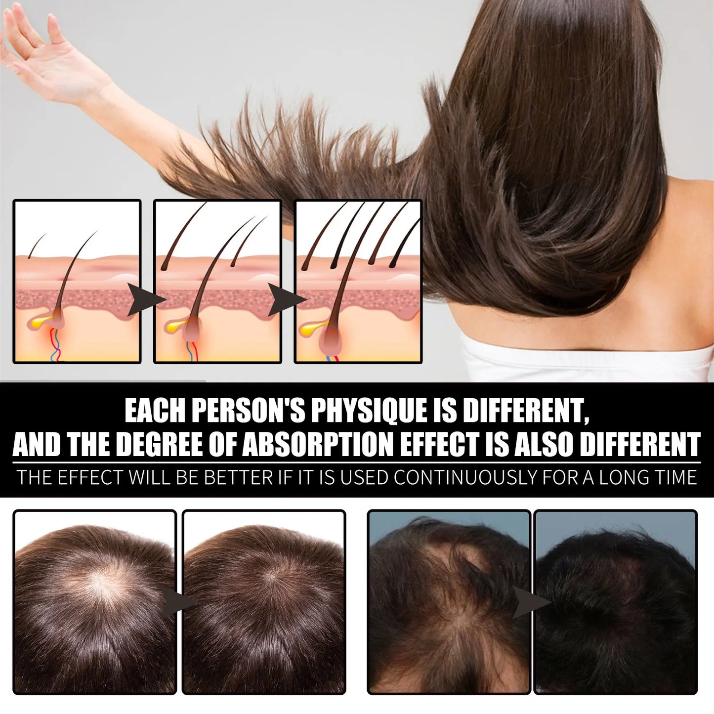 Collagen + Vitamin B7 Hair Care Oil for Hair Loss Prevention