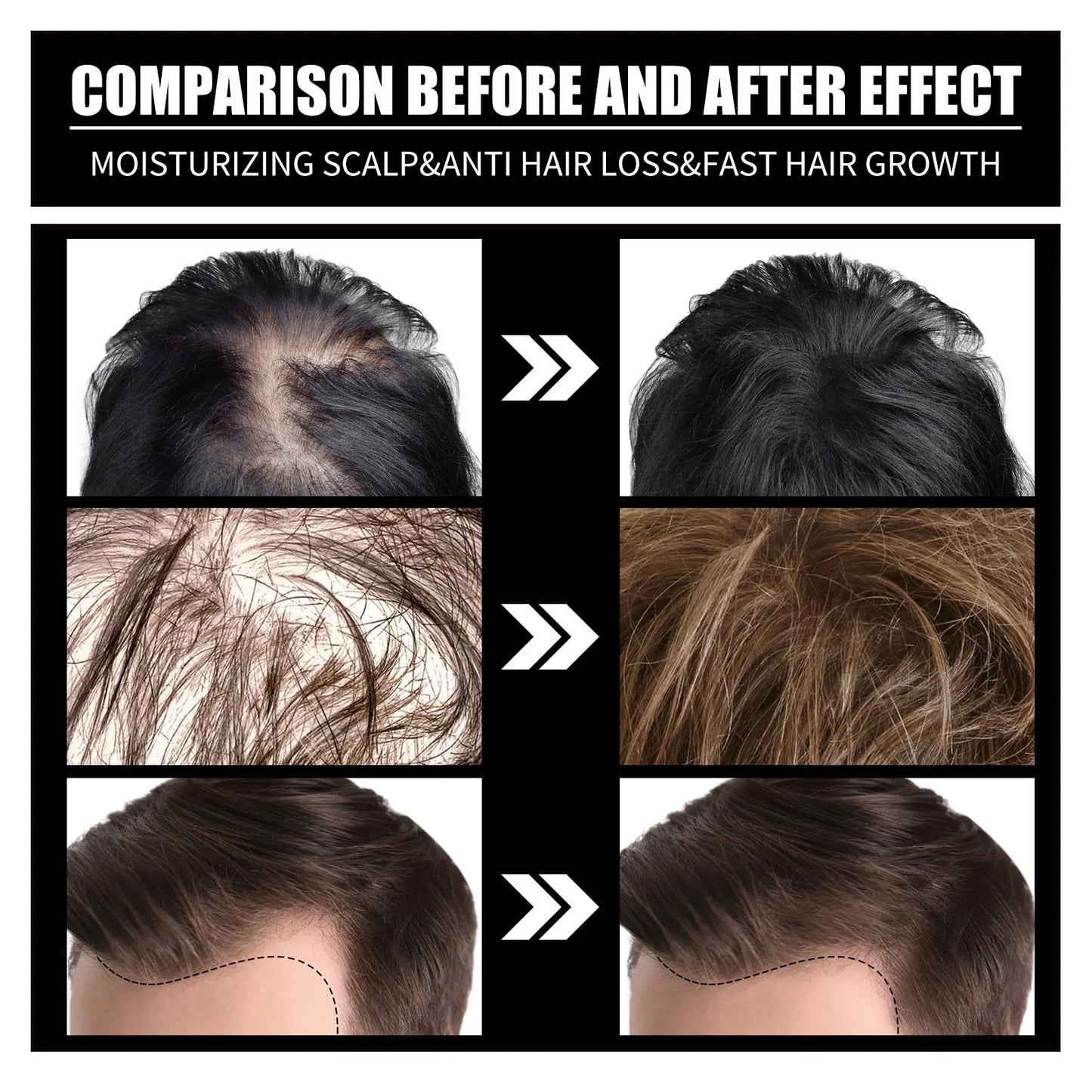 Collagen + Vitamin B7 Hair Care Oil for Hair Loss Prevention